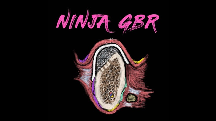 Ninja Guided Bone Regeneration