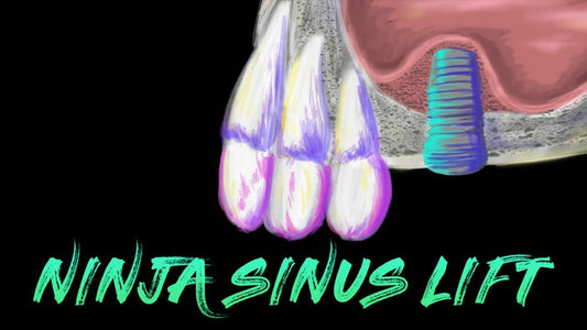 Ninja Sinus Lift